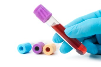 Blood-Test-Picture.jpg